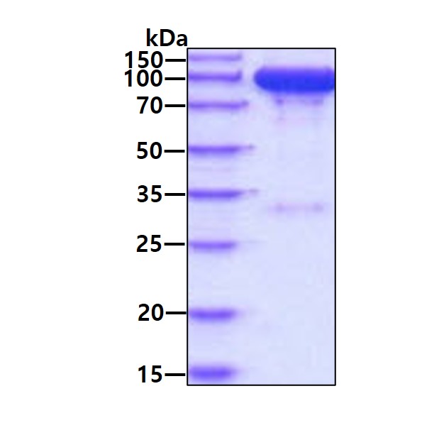 3 μg by SDS-PAGE under reducing condition and visualized by coomassie blue stain.